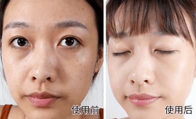 分析十大美白显著祛斑品牌:祛斑效果最好的排名第一(图3)