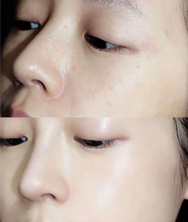 洗面奶哪个牌子最好用?洁面新选择让你拥有健康美肌!(图4)