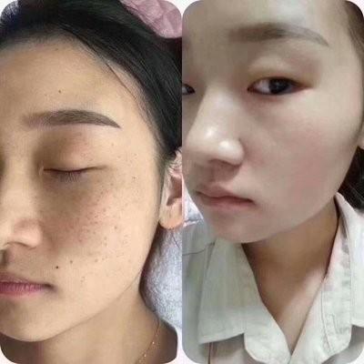 科学祛斑美白初源漾引领秋季护肤新风尚(图4)